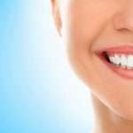 Deluxe Teeth Whitening Services